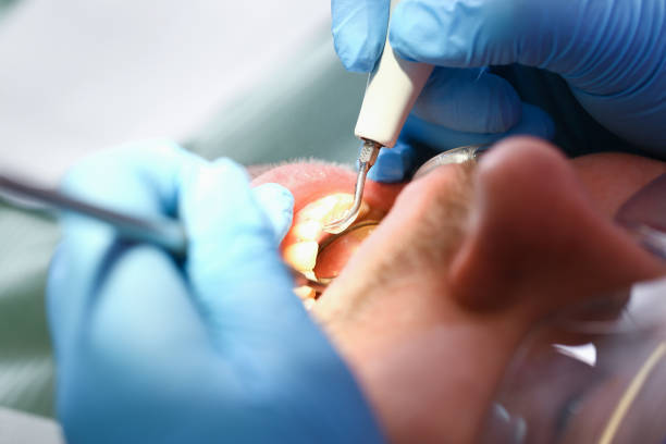 Best Emergency Dental Care for Broken or Chipped Teeth in Hidalgo, TX
